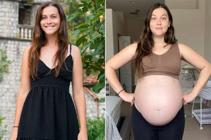 Emilie Ullerup Weight Gain: Before And After Photos