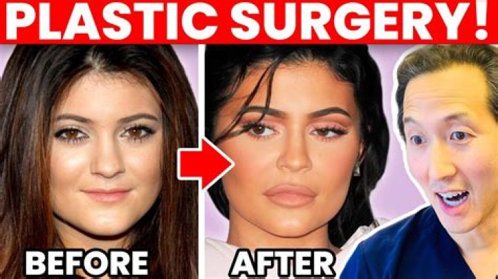 Sarah Lahbati Before Surgery: Plastic Surgery Transformation